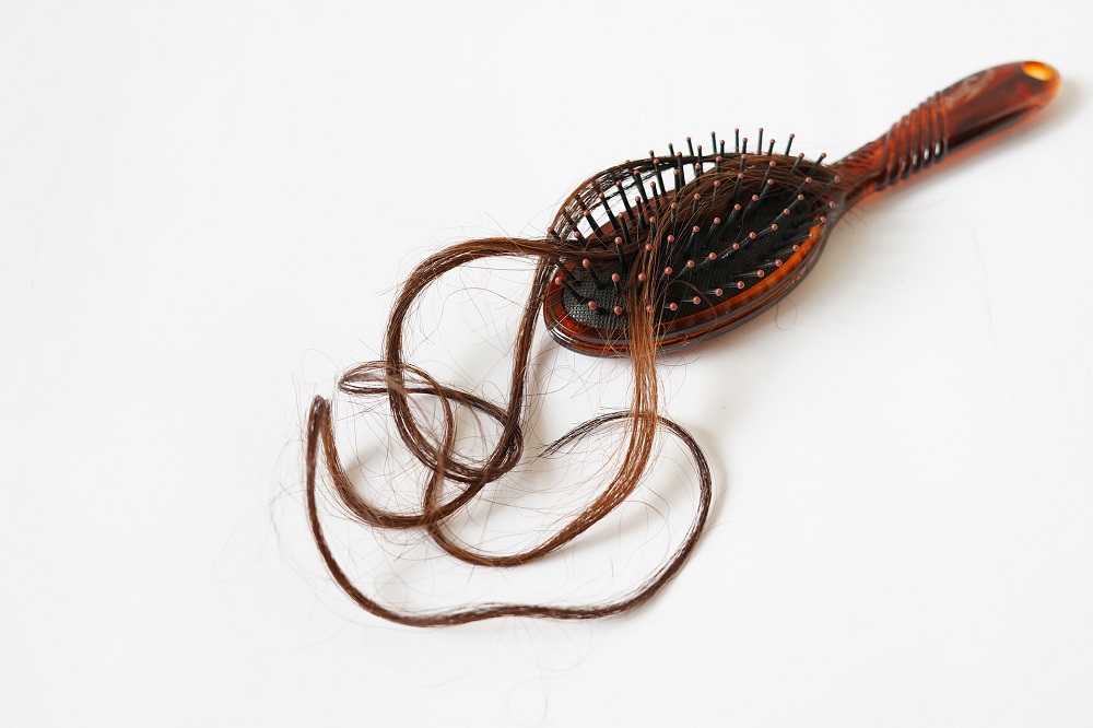 Votre perte de cheveux vous inquiète ? L'implant capillaire peut être une solution